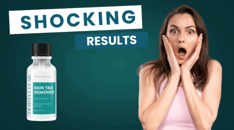 derma clear skin tag remover