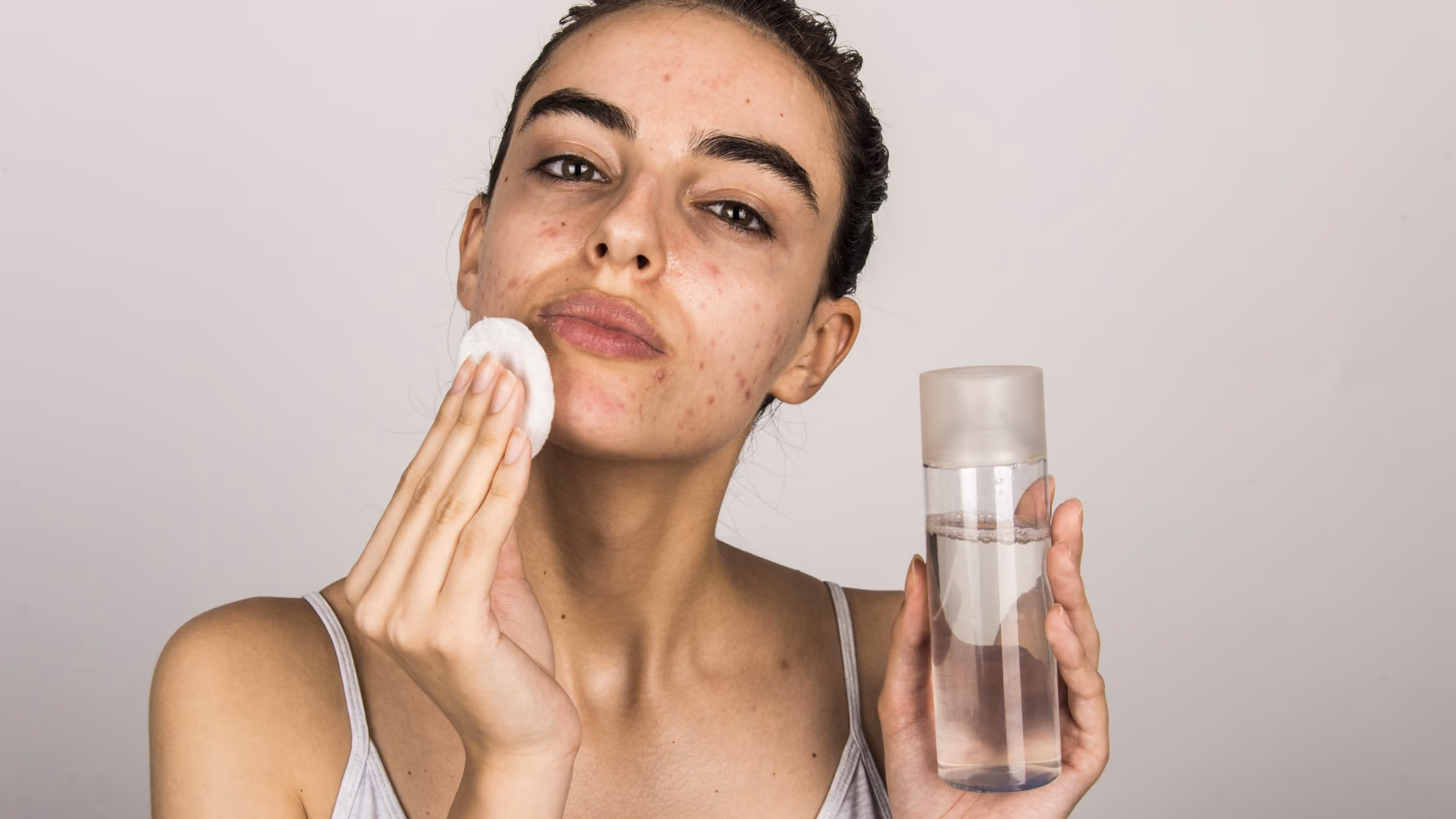 Best skincare routine for oily acne-prone skin