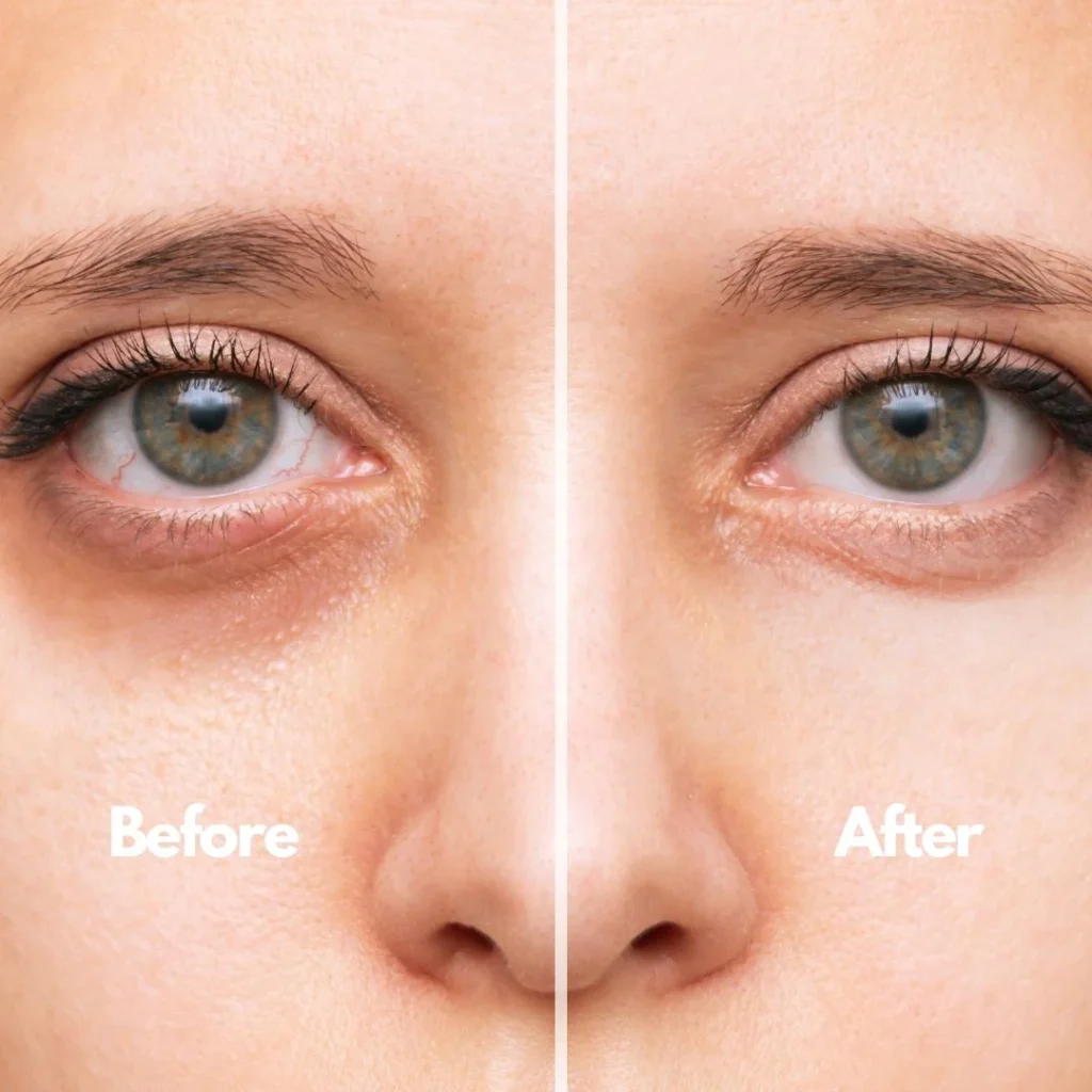 natural eye cream for fine lines under eyes