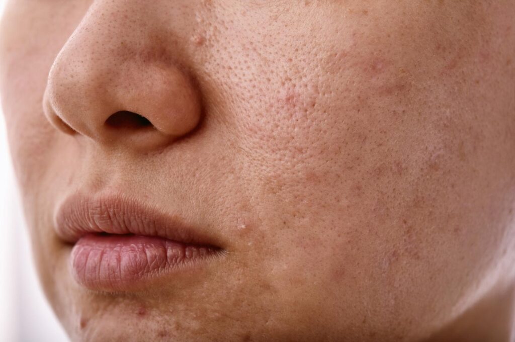 home remedies for dull and tired skin