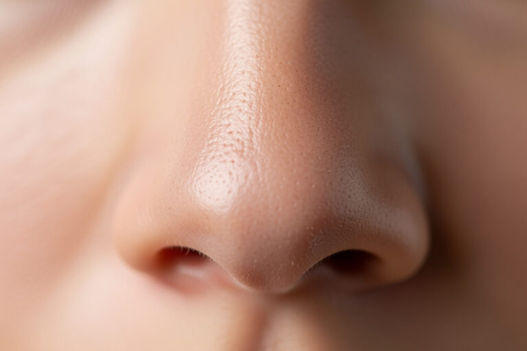 how to minimize pores on nose naturally
